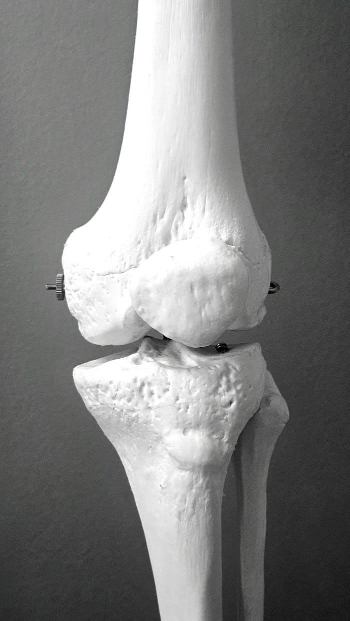 a black and white photo of a knee 27376664